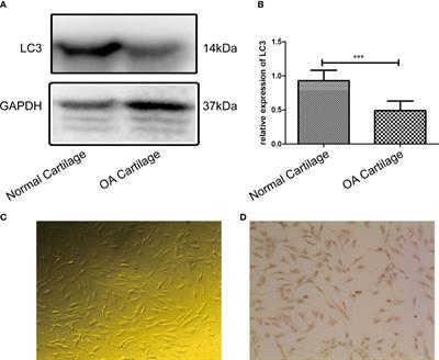 OPN inhibits autophagy through CD44, integrin and the MAPK pathway in osteoarthritic chondrocytes